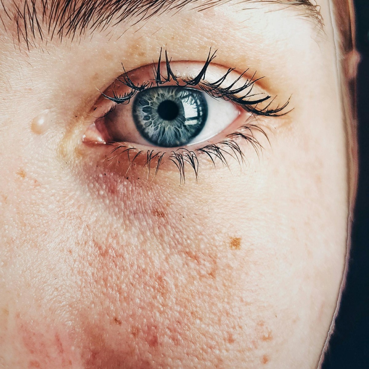 The Ultimate Guide to Understanding Pigmentation: Causes, Treatments, and&nbsp;Prevention